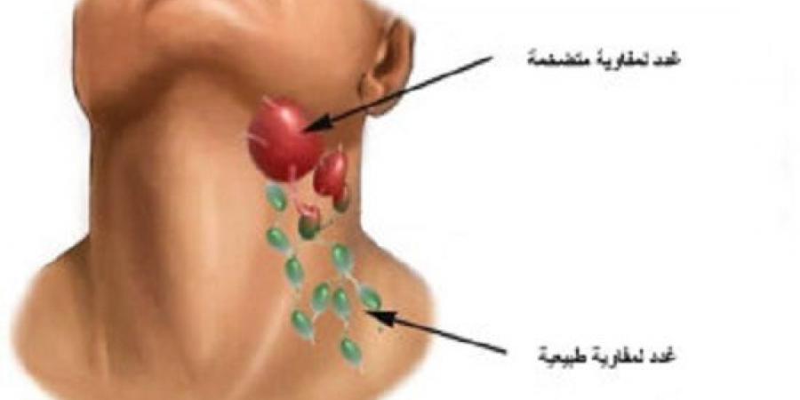 حسام موافي: الغدد اللمفاوية خط الدفاع الأول ضد الأمراض والالتهابات - جورنالك