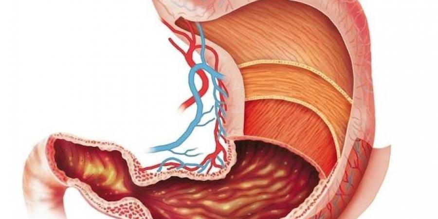 خطوات للحفاظ على صحة المعدة - جورنالك